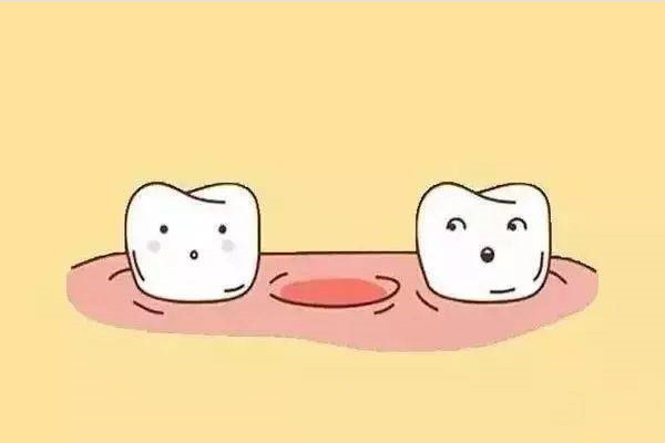 下午可以拔牙吗(下午可以拔牙吗什么