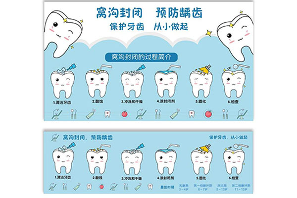 牙齿涂氟怎么收费(牙齿涂氟收费标准)