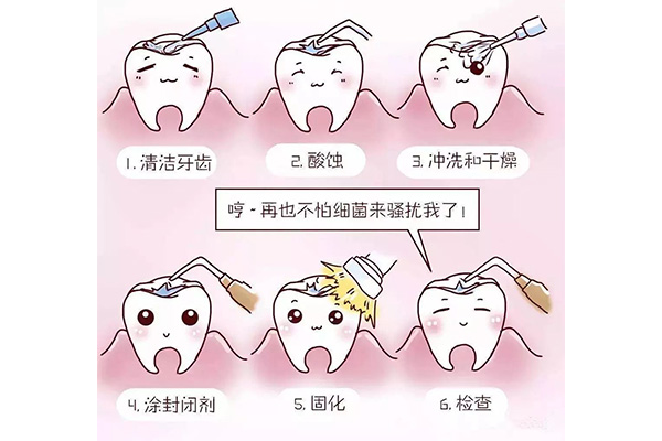 洗完牙涂氟后多久可以刷牙