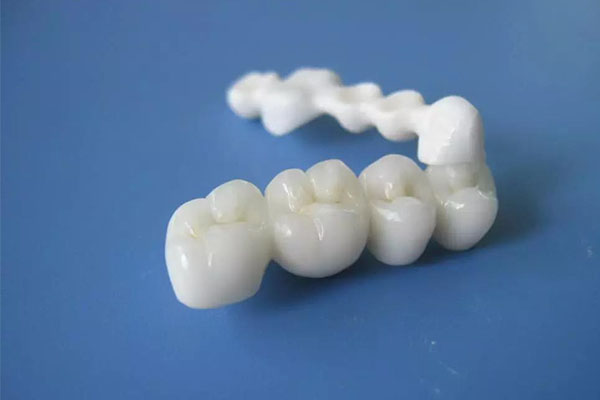 全瓷牙冠使用寿命十年怎么更换(全瓷