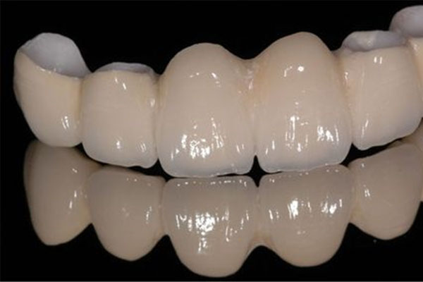 全瓷牙冠能用电动牙刷吗(全瓷牙冠能用电动牙刷吗多少钱)