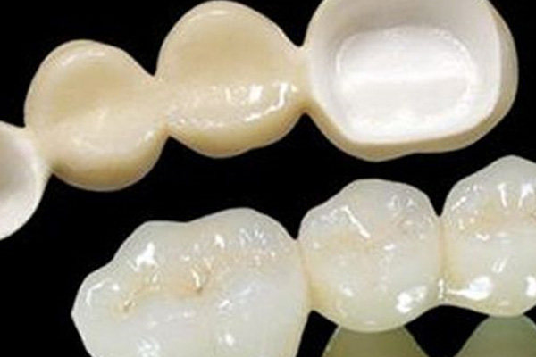全瓷牙和烤瓷牙哪个更结实些(全瓷牙
