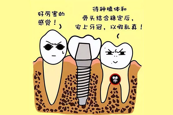 五十岁以后种牙(五十岁以后种牙有用吗)