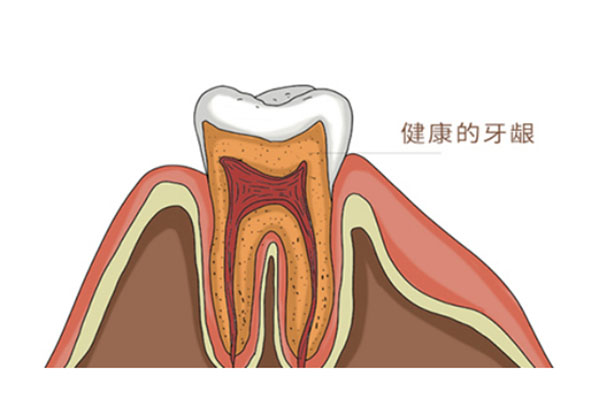 中医治疗根尖囊肿效果好吗(中医治疗根尖囊肿效果好吗知乎)