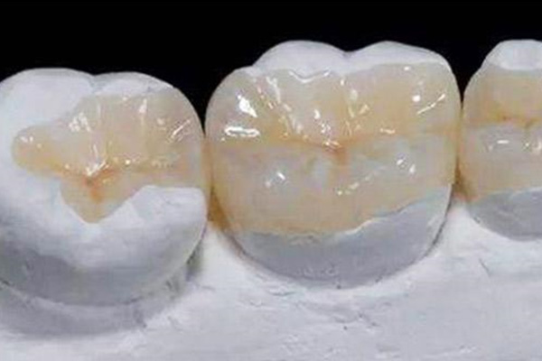 儿童地包天牙齿矫正器硅胶(地包天硅