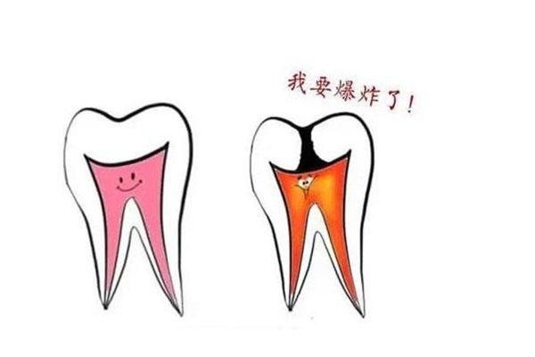 6岁蛀牙牙疼怎么办呢(6岁蛀牙牙疼怎么办呢图片)