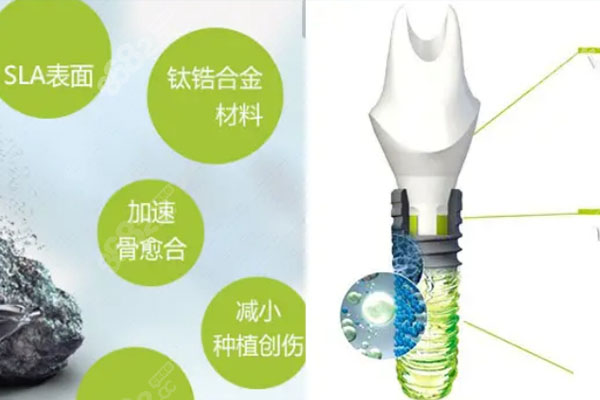 不能种牙还有什么方法(不能种牙还有