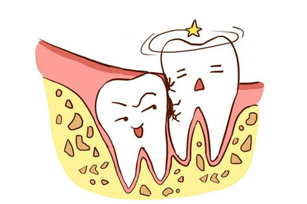 医院拔智齿便宜还是口腔诊所便宜一