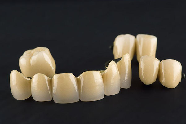 全瓷牙牙冠可以用多久(全瓷牙牙冠能