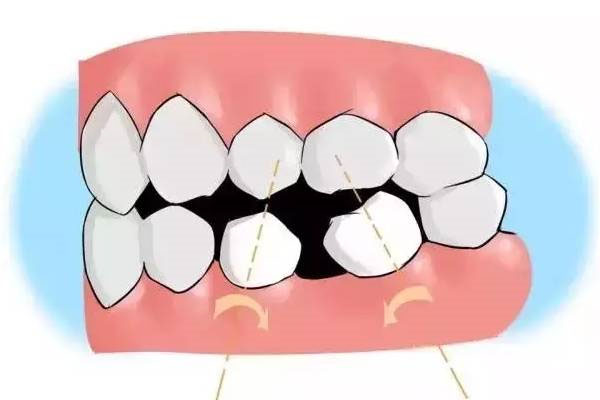 儿童掉牙一直不长怎么办(孩子牙掉了