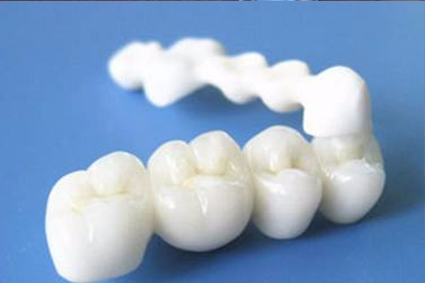 全瓷牙冠使用寿命价格(全瓷牙冠使用