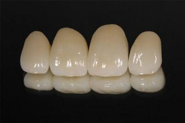 全瓷牙冠使用注意事项(全瓷牙冠使用