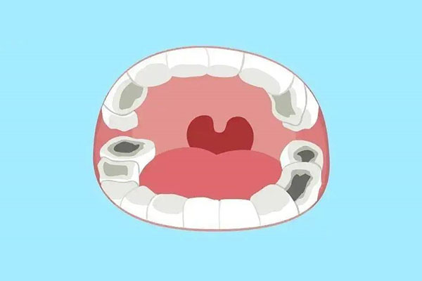 5岁孩子虫牙疼怎么止疼(5岁小孩虫牙