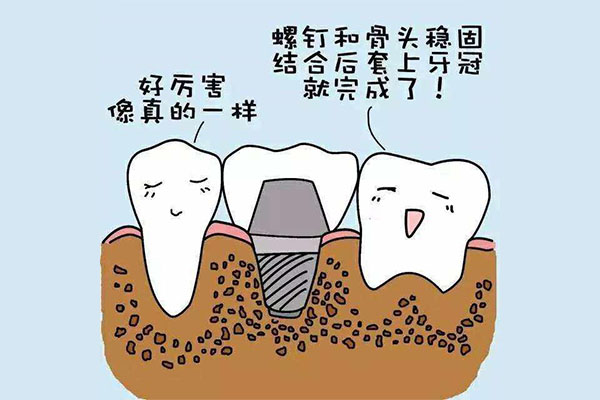 临沂种牙多少钱一颗啊(临沂种牙多少钱一颗啊)