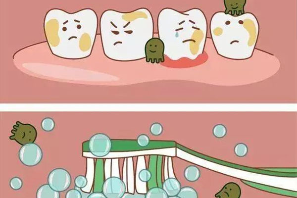 去烟牙黄的什么东西最管用呢