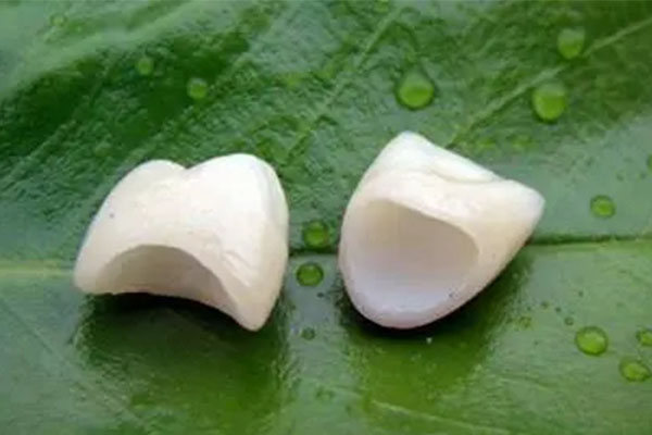 套牙冠多少钱一颗牙齿(套牙冠多少钱