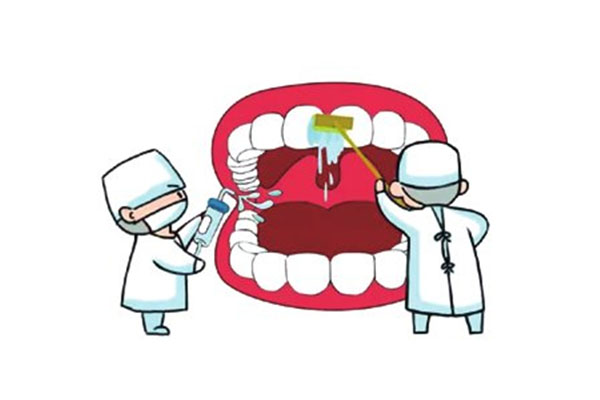儿童什么情况下做窝沟封闭(儿童什么情况下做窝沟封闭手术)