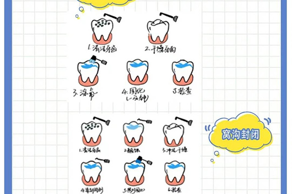 小孩牙齿涂氟有什么作用？家长必看
