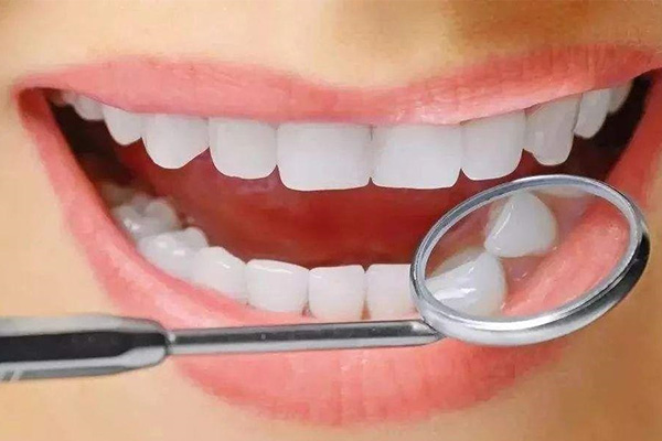 牙齿抛光可以美白吗(牙齿抛光可以美白吗)