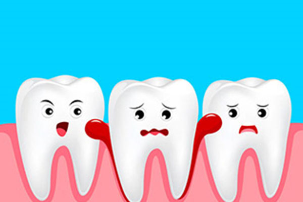 刷牙时牙龈老是出血缺什么维生素好