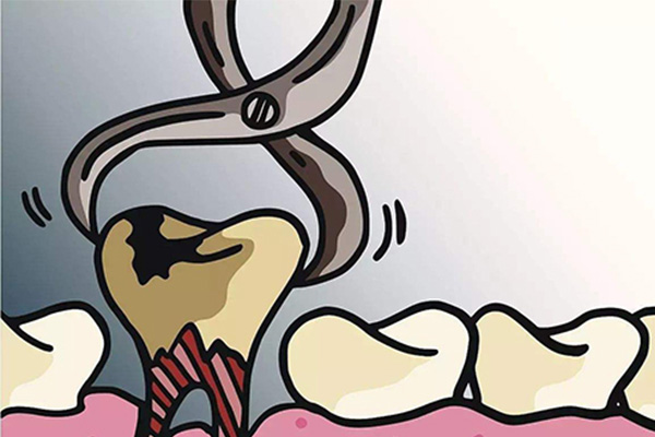 儿童拔牙疼不疼(儿童拔牙疼不疼危险吗)