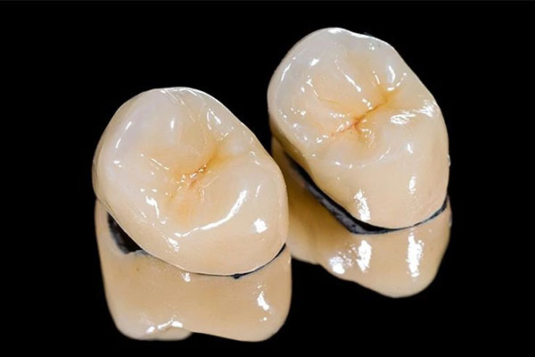 假牙模型多少钱(假牙价钱)