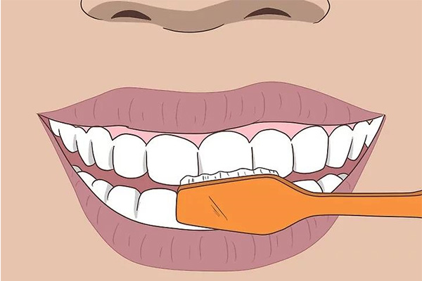 洁牙应该注意什么事项(洁牙应该注意