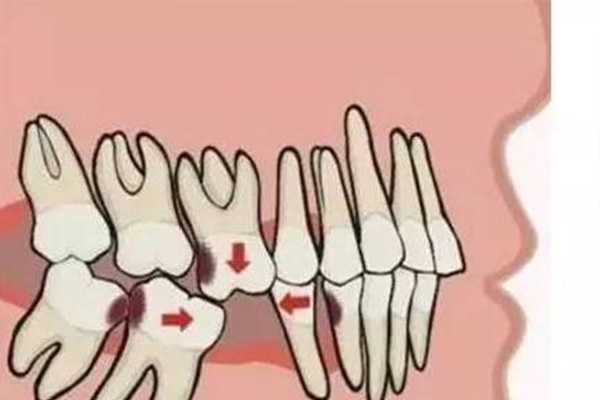 孩子七岁了还没掉牙(孩子七岁了还没掉牙怎么办)