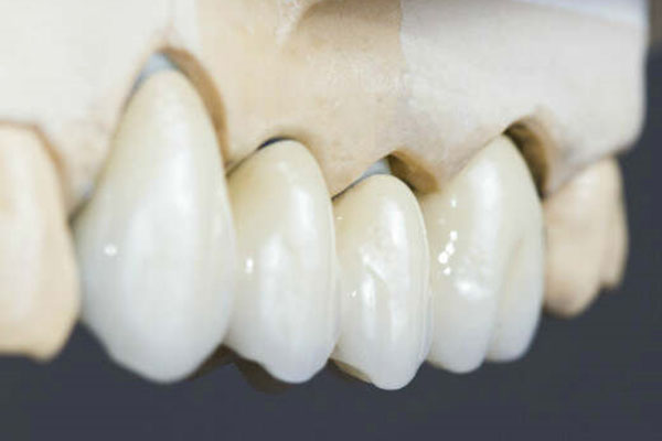 怎么治疗牙龈萎缩妙招(怎么治疗牙龈萎缩妙招视频)