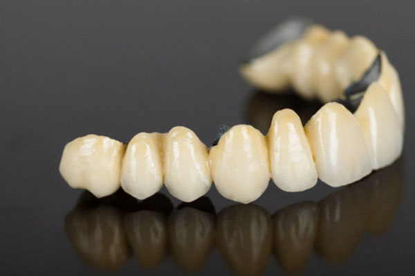 牙贴面会腐蚀牙齿吗(牙贴面会腐蚀牙