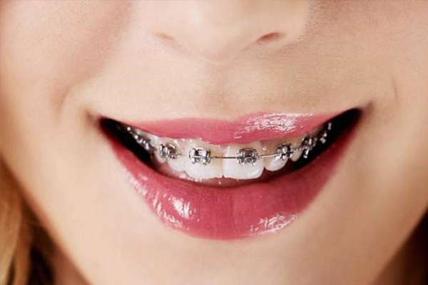 龅牙对眼睛的影响(龅牙对以后有影响吗)