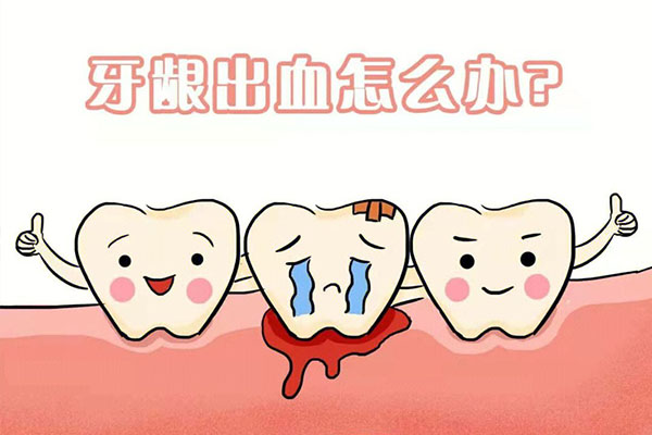 刷牙时老是出血是什么原因吃什么药