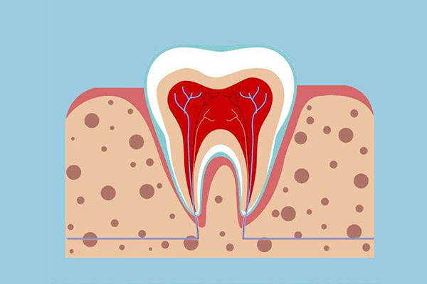 刷牙牙龈出血是什么症状