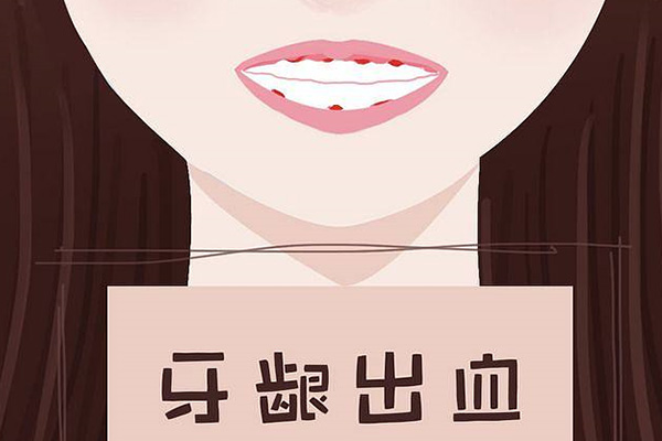 刷牙时牙龈出血用盐水漱口会不会有些好转
