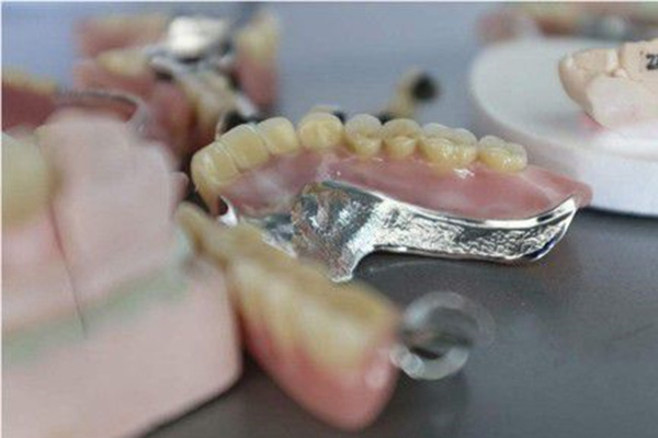 义齿费用鉴定方法(义齿费用鉴定方法