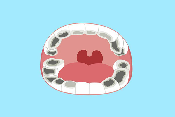 两岁多龋齿是不是没法补牙(两岁多龋