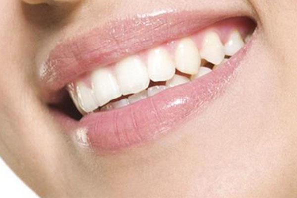 小孩牙齿有黑渍怎么回事什么是带状疱疹(请问小孩牙齿上有黑色