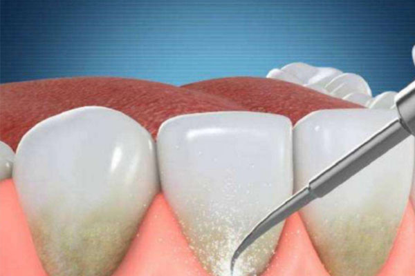 大黄牙怎么解决口臭问题(大黄牙怎么解决口臭问题视频)