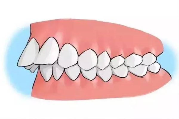 地包天成年后(地包天成年后会越来越严重吗)