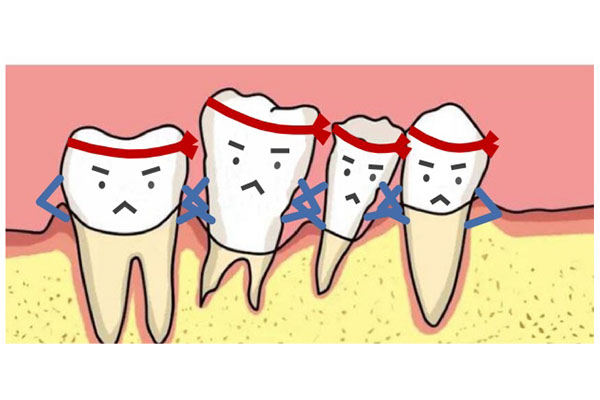 已经萎缩的牙龈怎么修复(已经萎缩的牙龈怎么修复呢)