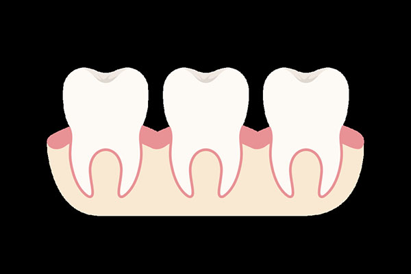 小孩牙根尖发炎有脓肿怎么治疗好得快(小孩牙根尖发炎有脓肿怎