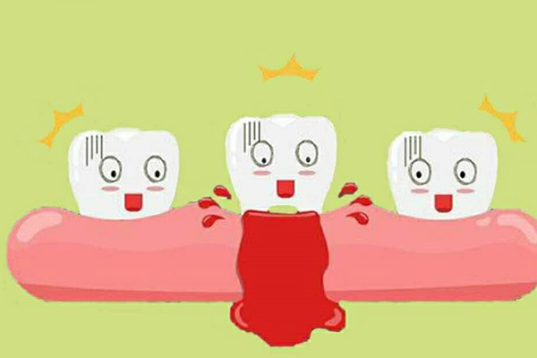 刷牙牙龈经常出血是什么原因引起的怎么办