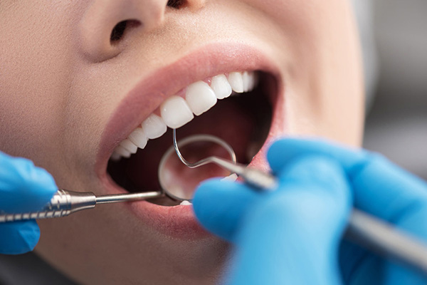 地包天怎么治疗费用大概多少(地包天的治疗方法)