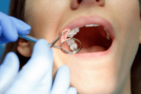 地包天戴牙套能改变脸型吗(地包天戴牙套会变龅牙吗)