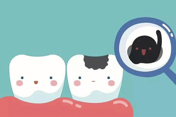 上海蛀牙修复多少钱(上海蛀牙修复多