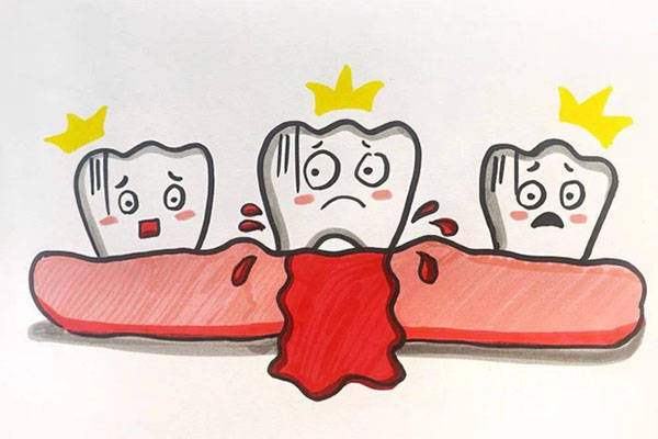 刷牙牙龈出血怎么治疗最有效的方法