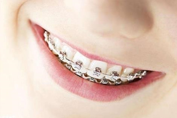 龅牙嘴突矫正(龅牙嘴巴突出矫正能恢复吗)