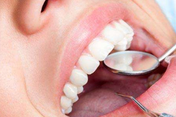 四环素牙发病机制是因为水中氟离子吗对吗(四环素牙产生的原因