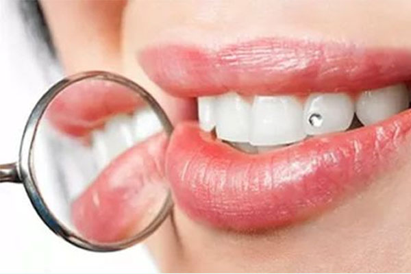 氟斑牙牙齿特点是(氟斑牙的特点是)