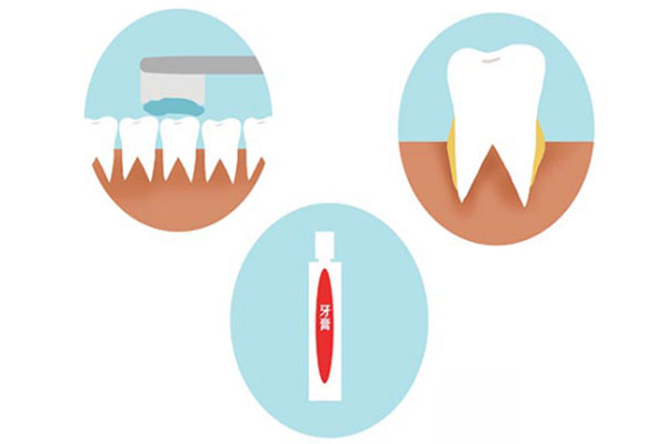 大门牙发黄疼怎么回事(大门牙发黄疼怎么回事吃什么药)